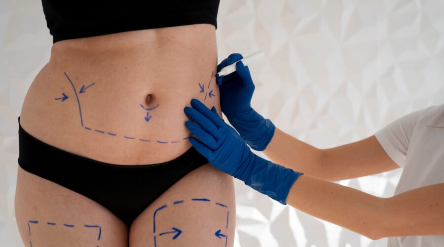 Lipoaspiração Quanto Custa? Tabela de Preços 2026